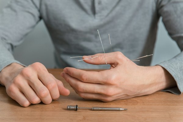 Quels sont les bienfaits de l'acupuncture pour la gestion des symptômes de la ménopause?
